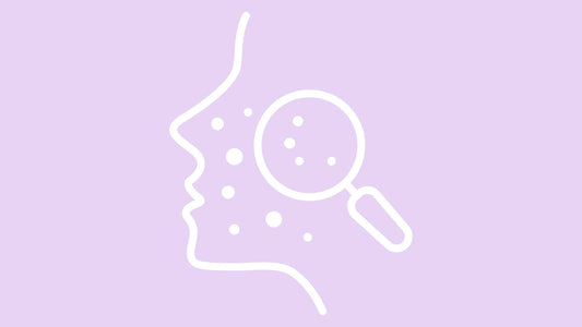 Hormonal Acne: Everything You Need to Know